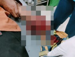Tangan Seorang Security BMKG Kendari Hancur Terkena Ledakan Petasan Rakitan