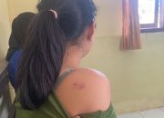 Siswi SMP di Konsel Dianiaya Sejumlah Siswa Hingga Lebam dan Pingsan, Keluarga Lapor Polisi
